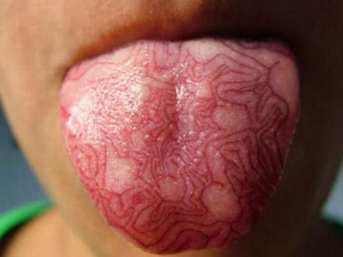 unique tongue